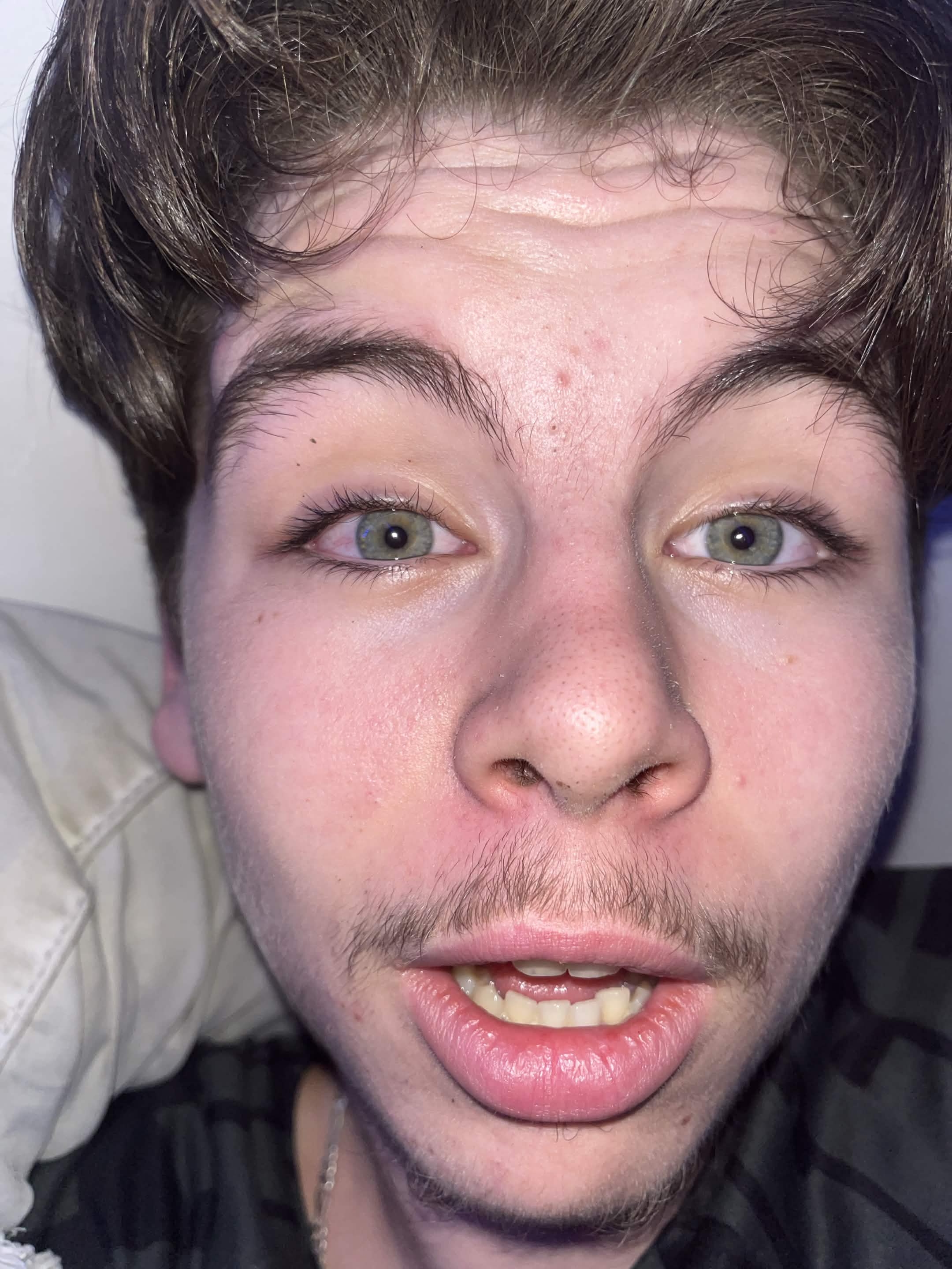 Tiago Stupéfait
